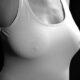 Augmentation mammaire bonnet A à B