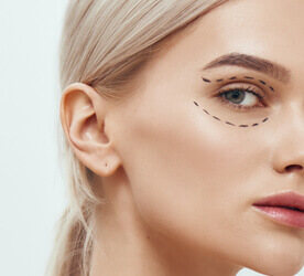 Blepharoplastie-Tunisie