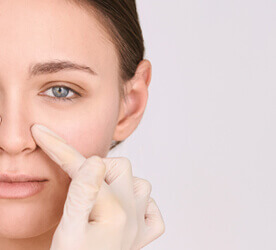 rhinoplastie