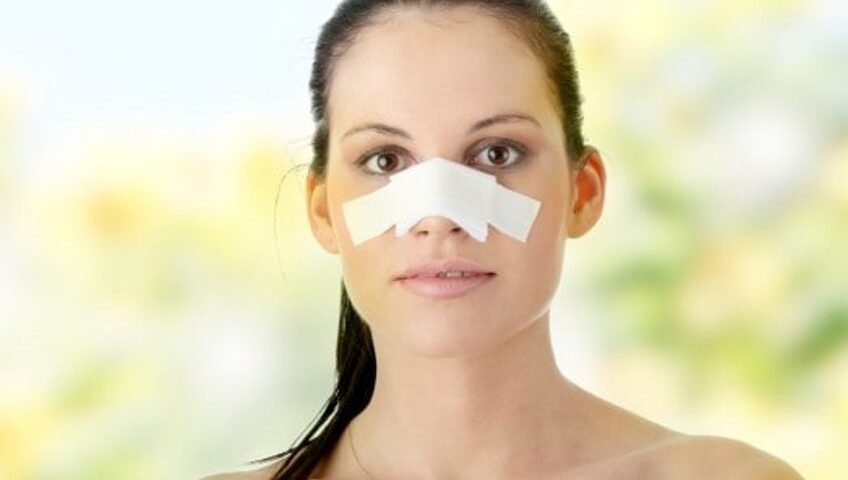 cicatrices-rhinoplastie