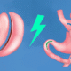 sleeve-ou-bypass