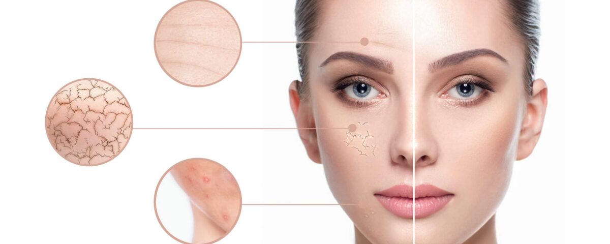 nouvelles-tendances-rajeunissement-visage