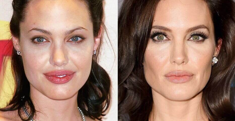 bichectomie-angelina-jolie