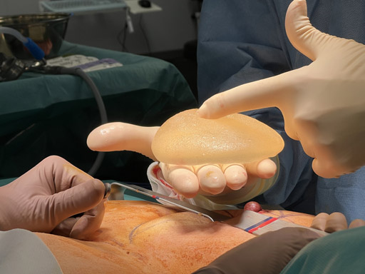 tendances-chirurgie-mammaire