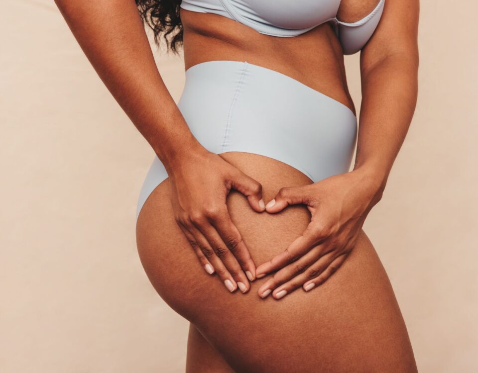 Traitement-lipœdème