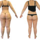 Liposuccion WAL-lipoedème