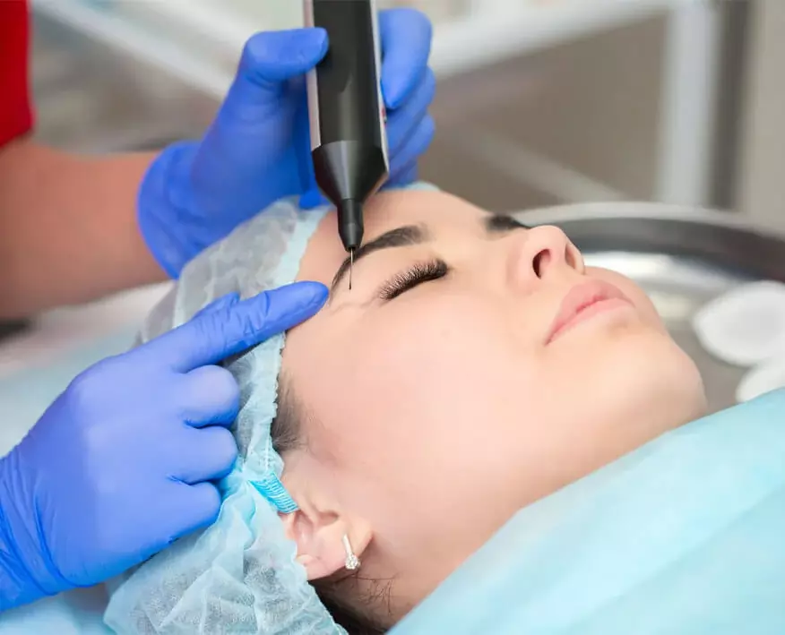 prix Blepharoplastie laser Tunisie